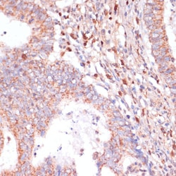 Invitrogen CACNB2 Polyclonal Antibody 100 &mu;L; Unconjugated:Antibodies,