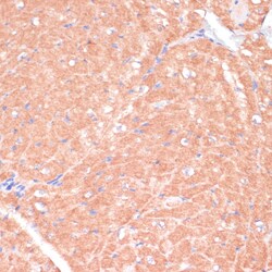 Invitrogen CACNB2 Polyclonal Antibody 100 &mu;L; Unconjugated:Antibodies,