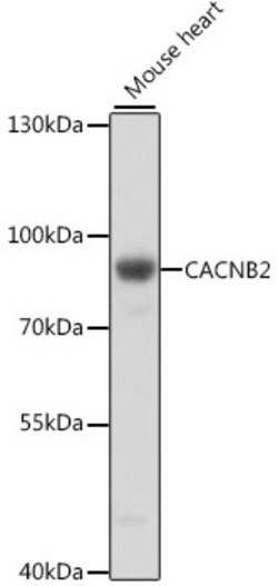 Invitrogen CACNB2 Polyclonal Antibody 100 &mu;L; Unconjugated:Antibodies,
