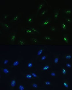 Invitrogen HNF4G Polyclonal Antibody 100 &mu;L; Unconjugated:Antibodies,