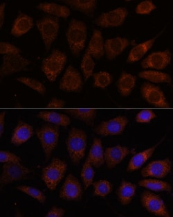 Invitrogen SEC24D Polyclonal Antibody 100 &mu;L; Unconjugated:Antibodies,