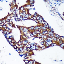 Invitrogen Epsin 2 Polyclonal Antibody 100 &mu;L; Unconjugated:Antibodies,