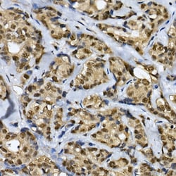 Invitrogen Cdc2L6 Polyclonal Antibody 100 &mu;L; Unconjugated:Antibodies,