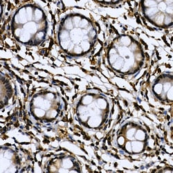 Invitrogen Cdc2L6 Polyclonal Antibody 100 &mu;L; Unconjugated:Antibodies,