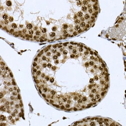 Invitrogen Cdc2L6 Polyclonal Antibody 100 &mu;L; Unconjugated:Antibodies,