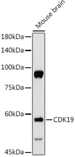 Invitrogen Cdc2L6 Polyclonal Antibody 100 &mu;L; Unconjugated:Antibodies,