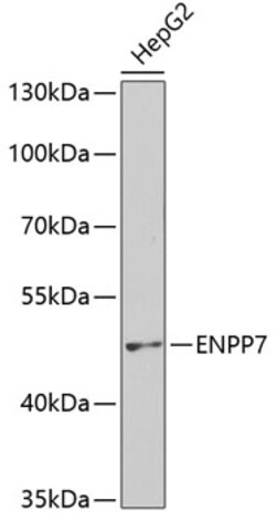 Invitrogen ENPP7 Polyclonal Antibody 100 &mu;L; Unconjugated:Antibodies,