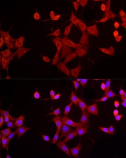 Invitrogen EpoR Polyclonal Antibody 100 &mu;L | Buy Online | Invitrogen&trade; | Fisher Scientific