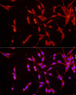 Invitrogen EpoR Polyclonal Antibody 100 &mu;L | Buy Online | Invitrogen&trade; | Fisher Scientific