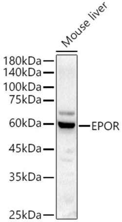 Invitrogen EpoR Polyclonal Antibody 100 &mu;L | Buy Online | Invitrogen&trade; | Fisher Scientific