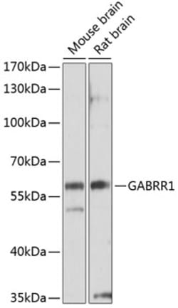 Invitrogen GABRR1 Polyclonal Antibody 100 &mu;L; Unconjugated:Antibodies,