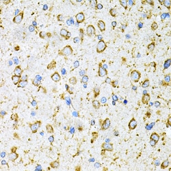 Invitrogen RAP Polyclonal Antibody 100 &mu;L | Buy Online | Invitrogen&trade; | Fisher Scientific