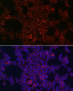 Invitrogen CSF1R Polyclonal Antibody 100 &mu;L; Unconjugated:Antibodies,