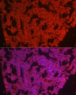 Invitrogen CSF1R Polyclonal Antibody 100 &mu;L; Unconjugated:Antibodies,