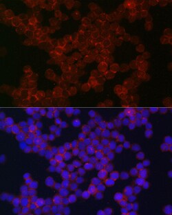 Invitrogen CSF1R Polyclonal Antibody 100 &mu;L; Unconjugated:Antibodies,