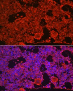 Invitrogen CSF1R Polyclonal Antibody 100 &mu;L; Unconjugated:Antibodies,