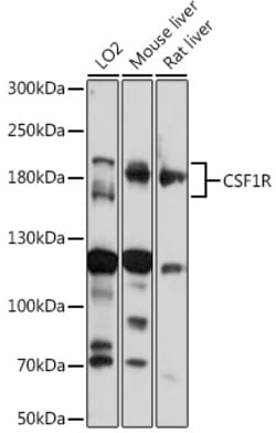 Invitrogen CSF1R Polyclonal Antibody 100 &mu;L; Unconjugated:Antibodies,
