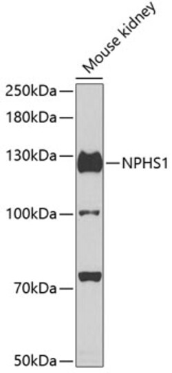 Invitrogen Nephrin Polyclonal Antibody 100 &mu;L; Unconjugated:Antibodies,
