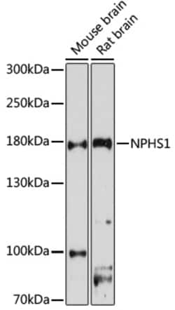 Invitrogen Nephrin Polyclonal Antibody 100 &mu;L; Unconjugated:Antibodies,