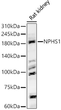 Invitrogen Nephrin Polyclonal Antibody 100 &mu;L; Unconjugated:Antibodies,