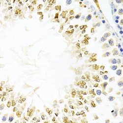 Invitrogen Gemin 2 Polyclonal Antibody 100 &mu;L; Unconjugated:Antibodies,