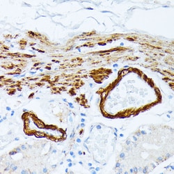 Invitrogen TPM2 Polyclonal Antibody 100 &mu;L; Unconjugated:Antibodies,