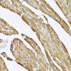 Invitrogen TPM2 Polyclonal Antibody 100 &mu;L; Unconjugated:Antibodies,