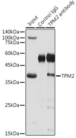 Invitrogen TPM2 Polyclonal Antibody 100 &mu;L; Unconjugated:Antibodies,