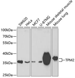 Invitrogen TPM2 Polyclonal Antibody 100 &mu;L; Unconjugated:Antibodies,