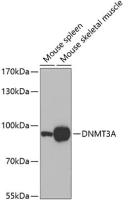 Invitrogen DNMT3A Polyclonal Antibody 100 &mu;L; Unconjugated:Antibodies,