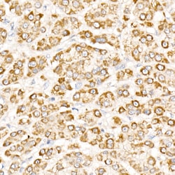 Invitrogen NLK Polyclonal Antibody 100 &mu;L; Unconjugated:Antibodies,