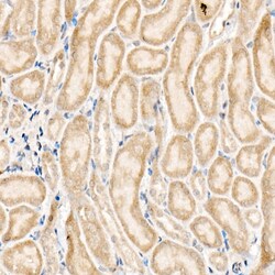 Invitrogen NLK Polyclonal Antibody 100 &mu;L; Unconjugated:Antibodies,