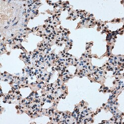 Invitrogen RBM17 Polyclonal Antibody 100 &mu;L; Unconjugated:Antibodies,