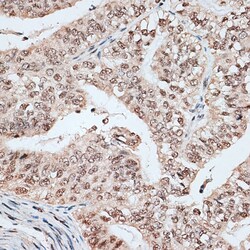 Invitrogen RBM17 Polyclonal Antibody 100 &mu;L; Unconjugated:Antibodies,