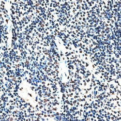 Invitrogen RBM17 Polyclonal Antibody 100 &mu;L; Unconjugated:Antibodies,
