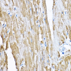 Invitrogen SAMM50 Polyclonal Antibody 100 &mu;L; Unconjugated:Antibodies,