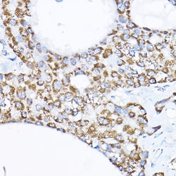 Invitrogen SAMM50 Polyclonal Antibody 100 &mu;L; Unconjugated:Antibodies,
