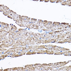 Invitrogen SAMM50 Polyclonal Antibody 100 &mu;L; Unconjugated:Antibodies,