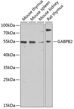 Invitrogen GABPB2 Polyclonal Antibody 100 &mu;L | Buy Online | Invitrogen&trade; | Fisher Scientific
