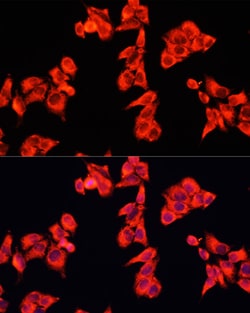 Invitrogen ARHGAP5 Polyclonal Antibody 100 &mu;L; Unconjugated:Antibodies,