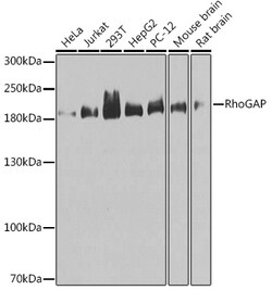 Invitrogen ARHGAP5 Polyclonal Antibody 100 &mu;L; Unconjugated:Antibodies,