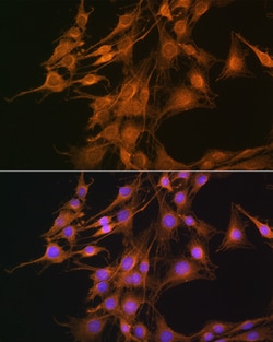 Invitrogen ELOVL4 Polyclonal Antibody 100 &mu;L; Unconjugated:Antibodies,