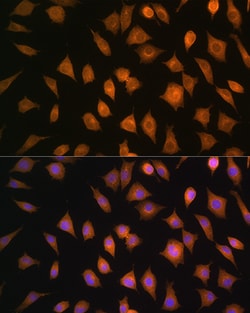 Invitrogen ELOVL4 Polyclonal Antibody 100 &mu;L; Unconjugated:Antibodies,