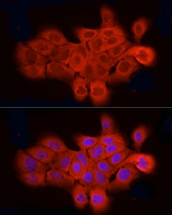 Invitrogen ELOVL4 Polyclonal Antibody 100 &mu;L; Unconjugated:Antibodies,