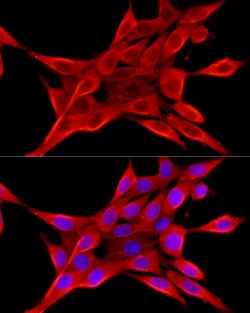 Invitrogen ELOVL4 Polyclonal Antibody 100 &mu;L; Unconjugated:Antibodies,