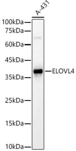 Invitrogen ELOVL4 Polyclonal Antibody 100 &mu;L; Unconjugated:Antibodies,