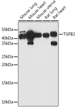 Invitrogen TGF beta-2 Polyclonal Antibody 100 &mu;L | Buy Online | Invitrogen&trade; | Fisher Scientific