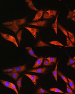 Invitrogen Aldolase B Polyclonal Antibody 100 &mu;L; Unconjugated:Antibodies,