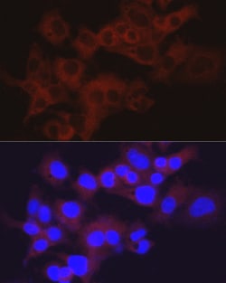 Invitrogen Aldolase B Polyclonal Antibody 100 &mu;L; Unconjugated:Antibodies,