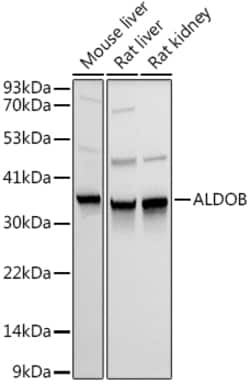 Invitrogen Aldolase B Polyclonal Antibody 100 &mu;L; Unconjugated:Antibodies,